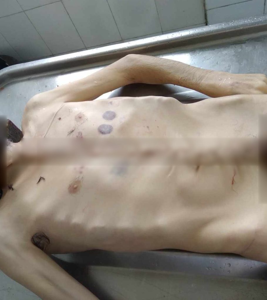 The body of a man who starved to death. Photo from the NK Ombudsman's Facebook page