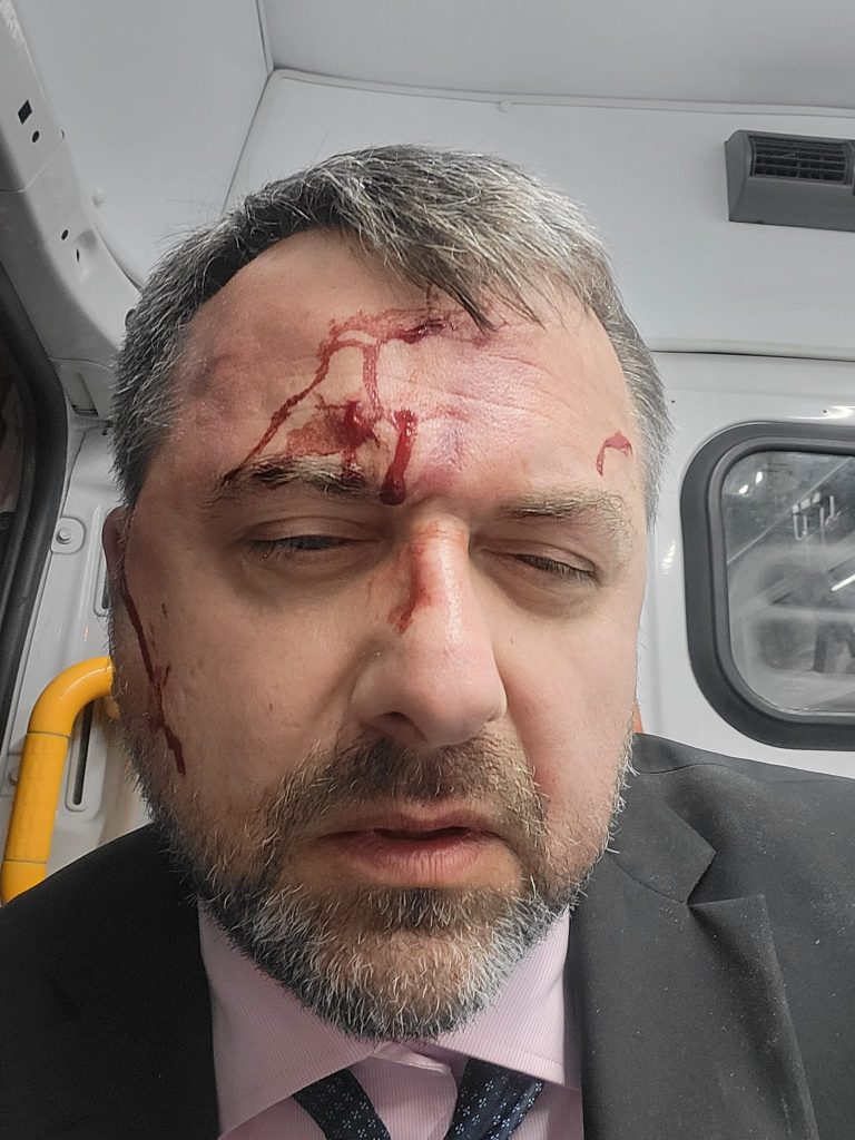 Gia Japaridze, an expert in international relations. Opponents of Georgia's foreign agents' bill beaten