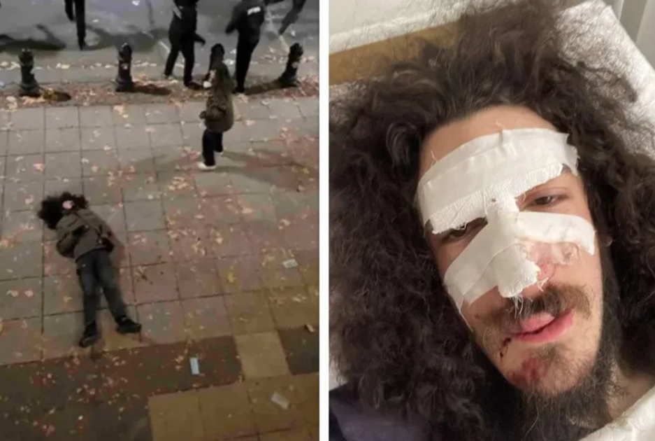 On the right in the photo is Zviadi Maisashvili in the clinic, and on the left is the beaten Zviadi on Rustaveli Avenue, unconscious.