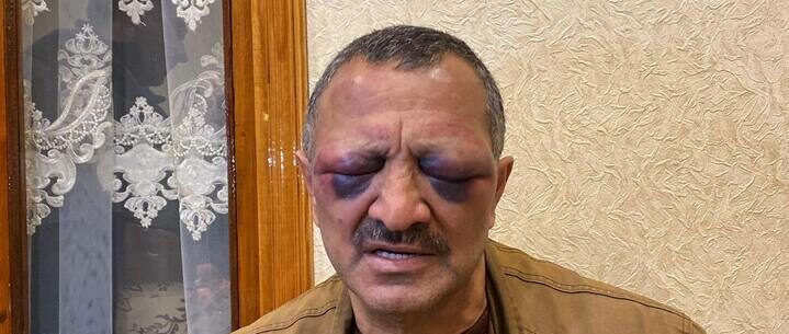 Tofiq Yaqublu. Foto: Ramin Deko
Azərbaycanda etiraz aksiyaları